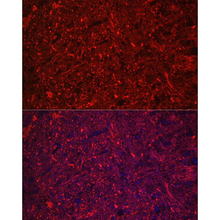 Immunofluorescence - Anti-68kDa Neurofilament/NF-L Antibody [ARC50056] (A308799) - Antibodies.com