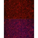 Immunofluorescence - Anti-68kDa Neurofilament/NF-L Antibody [ARC50056] (A308799) - Antibodies.com