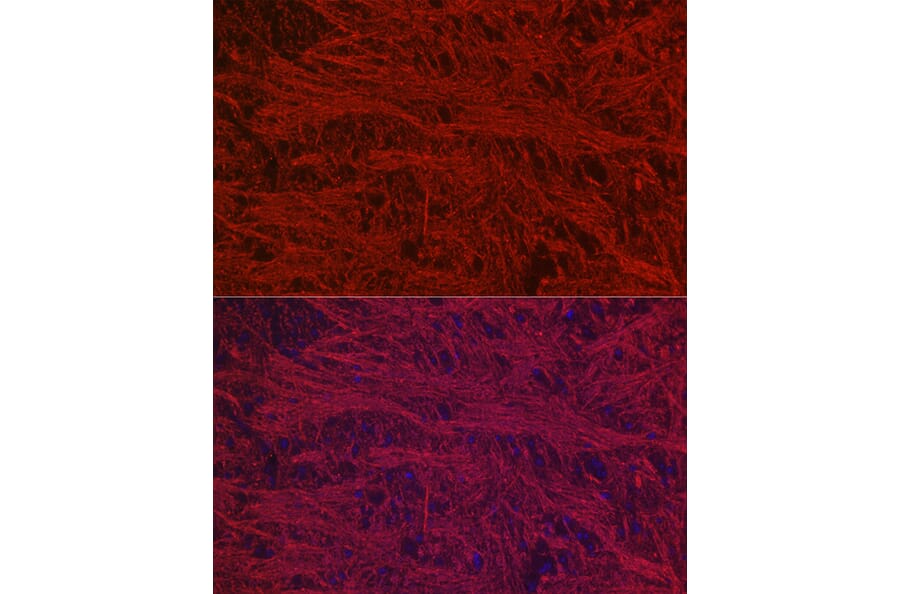 Immunofluorescence - Anti-68kDa Neurofilament/NF-L Antibody [ARC50056] (A308799) - Antibodies.com