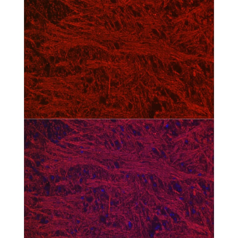 Immunofluorescence - Anti-68kDa Neurofilament/NF-L Antibody [ARC50056] (A308799) - Antibodies.com