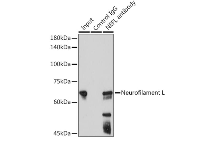 Western Blot - Anti-68kDa Neurofilament/NF-L Antibody [ARC50056] (A308799) - Antibodies.com