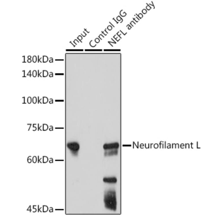 Western Blot - Anti-68kDa Neurofilament/NF-L Antibody [ARC50056] (A308799) - Antibodies.com