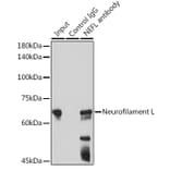 Western Blot - Anti-68kDa Neurofilament/NF-L Antibody [ARC50056] (A308799) - Antibodies.com
