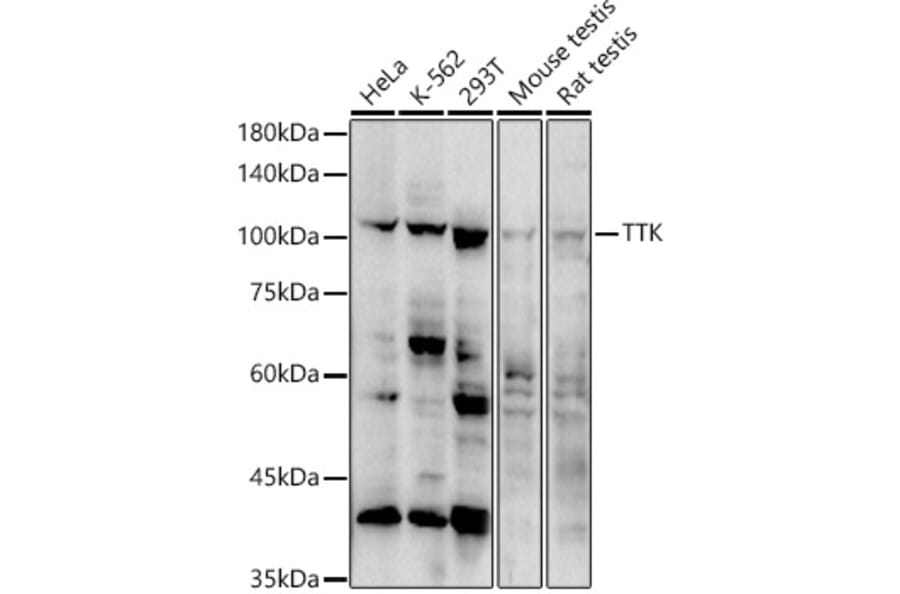 Western Blot - Anti-TTK/Mps1 Antibody (A308801) - Antibodies.com