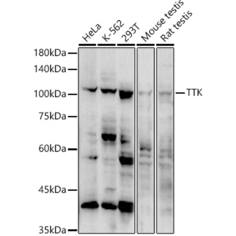 Western Blot - Anti-TTK/Mps1 Antibody (A308801) - Antibodies.com