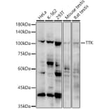 Western Blot - Anti-TTK/Mps1 Antibody (A308801) - Antibodies.com