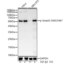 Western Blot - Anti-Smad2 (phospho Ser465 + Ser467) Antibody [ARC56317] (A308802) - Antibodies.com