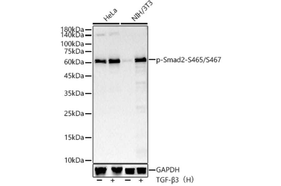 Western Blot - Anti-Smad2 (phospho Ser465 + Ser467) Antibody [ARC56317] (A308802) - Antibodies.com