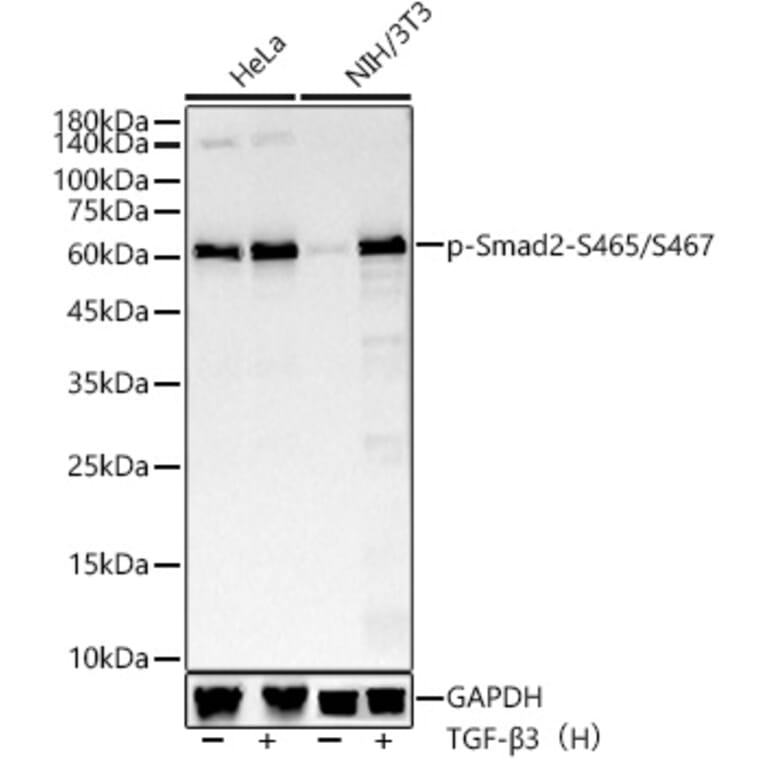 Western Blot - Anti-Smad2 (phospho Ser465 + Ser467) Antibody [ARC56317] (A308802) - Antibodies.com