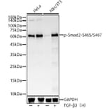 Western Blot - Anti-Smad2 (phospho Ser465 + Ser467) Antibody [ARC56317] (A308802) - Antibodies.com
