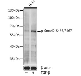 Western Blot - Anti-Smad2 (phospho Ser465 + Ser467) Antibody (A308803) - Antibodies.com