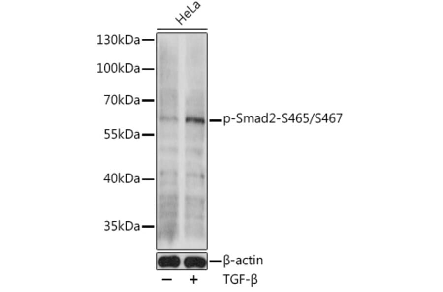 Western Blot - Anti-Smad2 (phospho Ser465 + Ser467) Antibody (A308803) - Antibodies.com