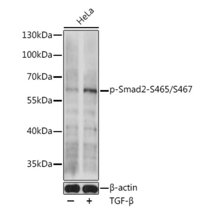 Western Blot - Anti-Smad2 (phospho Ser465 + Ser467) Antibody (A308803) - Antibodies.com