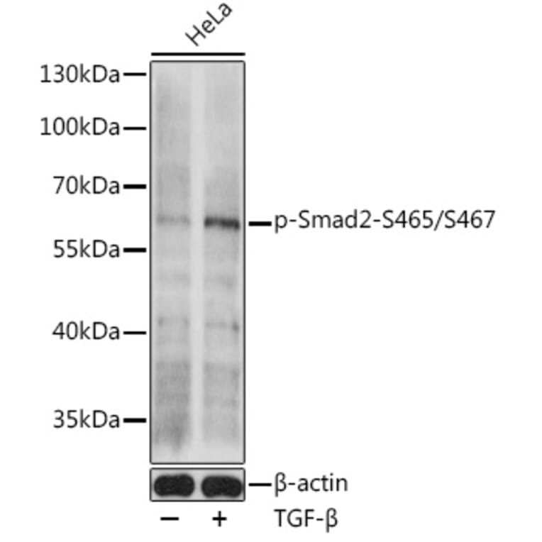 Western Blot - Anti-Smad2 (phospho Ser465 + Ser467) Antibody (A308803) - Antibodies.com