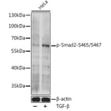 Western Blot - Anti-Smad2 (phospho Ser465 + Ser467) Antibody (A308803) - Antibodies.com