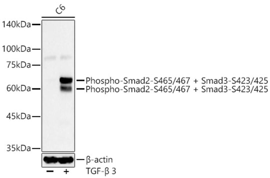 Western Blot - Anti-Smad2 (phospho Ser465 + Ser467) + Smad3 (phospho Ser423 + Ser425) Antibody [ARC56314] (A308804) - Antibodies.com