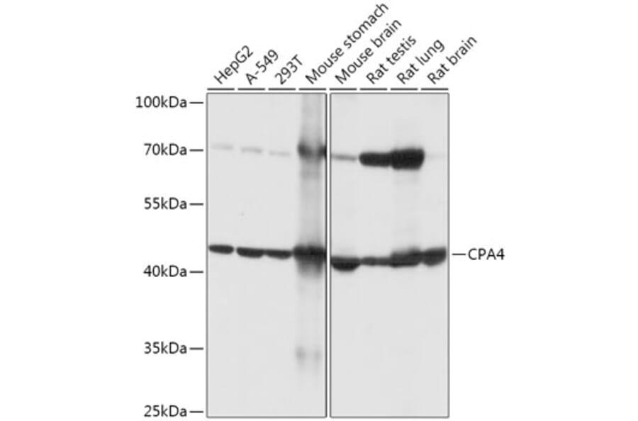 Western Blot - Anti-CPA4 Antibody (A308805) - Antibodies.com