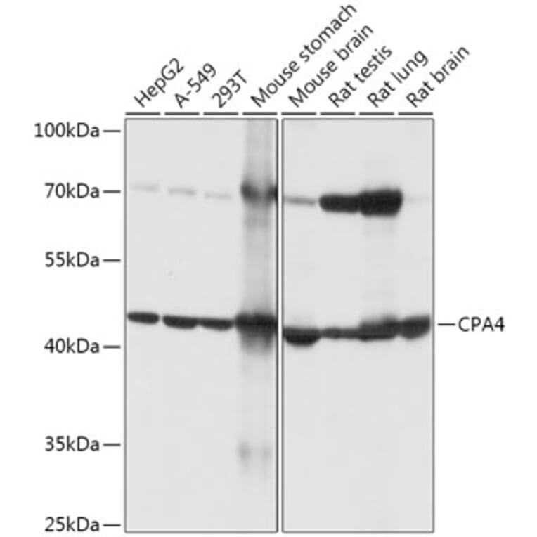 Western Blot - Anti-CPA4 Antibody (A308805) - Antibodies.com