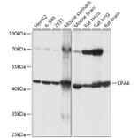 Western Blot - Anti-CPA4 Antibody (A308805) - Antibodies.com