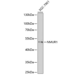 Western Blot - Anti-NMUR1 Antibody (A308806) - Antibodies.com