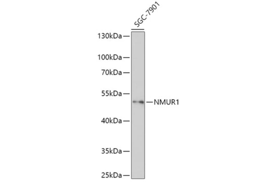 Western Blot - Anti-NMUR1 Antibody (A308806) - Antibodies.com