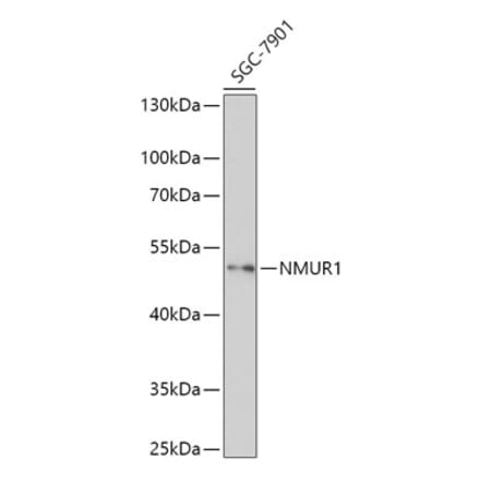 Western Blot - Anti-NMUR1 Antibody (A308806) - Antibodies.com