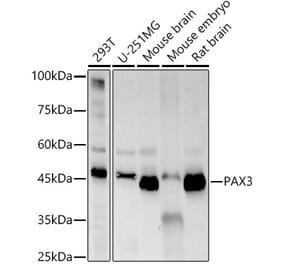 Western Blot - Anti-PAX3 Antibody [ARC57259] (A308807) - Antibodies.com