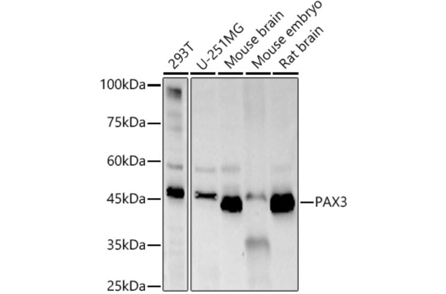 Western Blot - Anti-PAX3 Antibody [ARC57259] (A308807) - Antibodies.com