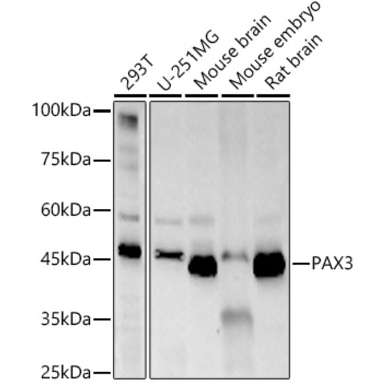Western Blot - Anti-PAX3 Antibody [ARC57259] (A308807) - Antibodies.com