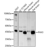 Western Blot - Anti-PAX3 Antibody [ARC57259] (A308807) - Antibodies.com
