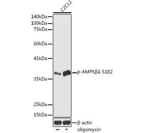 Western Blot - Anti-AMPK beta 1 (phospho Ser182) Antibody (A308809) - Antibodies.com
