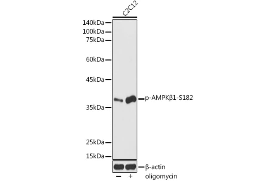 Western Blot - Anti-AMPK beta 1 (phospho Ser182) Antibody (A308809) - Antibodies.com