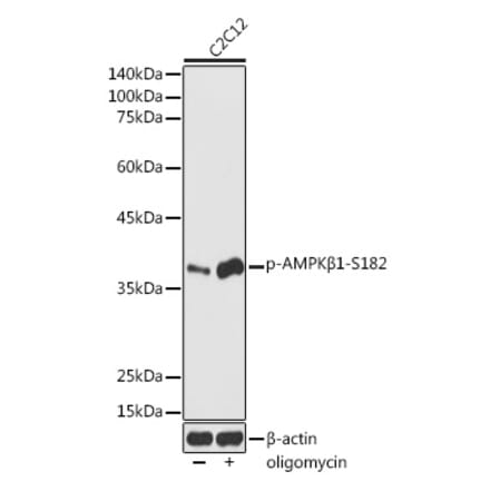 Western Blot - Anti-AMPK beta 1 (phospho Ser182) Antibody (A308809) - Antibodies.com