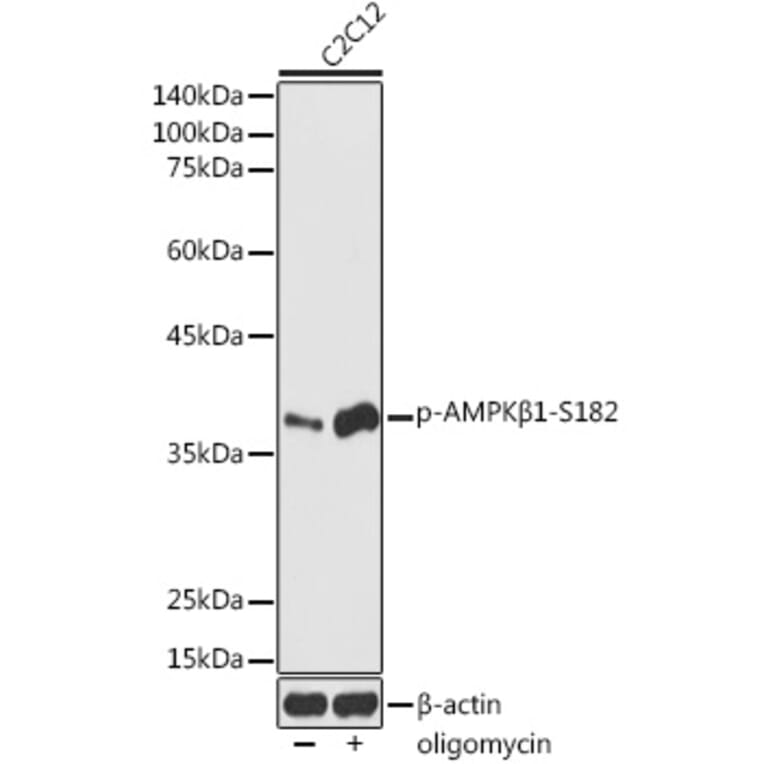 Western Blot - Anti-AMPK beta 1 (phospho Ser182) Antibody (A308809) - Antibodies.com