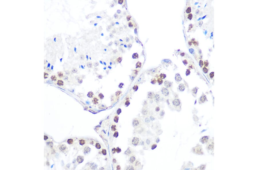 Immunohistochemistry - Anti-AMPK beta 1 (phospho Ser182) Antibody (A308809) - Antibodies.com