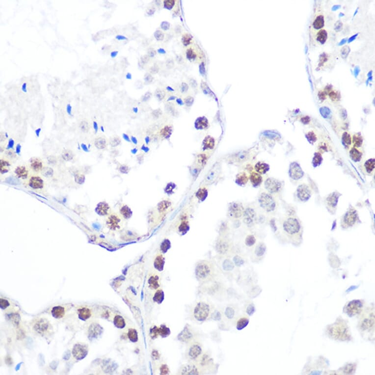 Immunohistochemistry - Anti-AMPK beta 1 (phospho Ser182) Antibody (A308809) - Antibodies.com