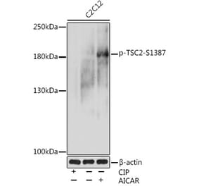 Western Blot - Anti-Tuberin (phospho Ser1387) Antibody (A308810) - Antibodies.com