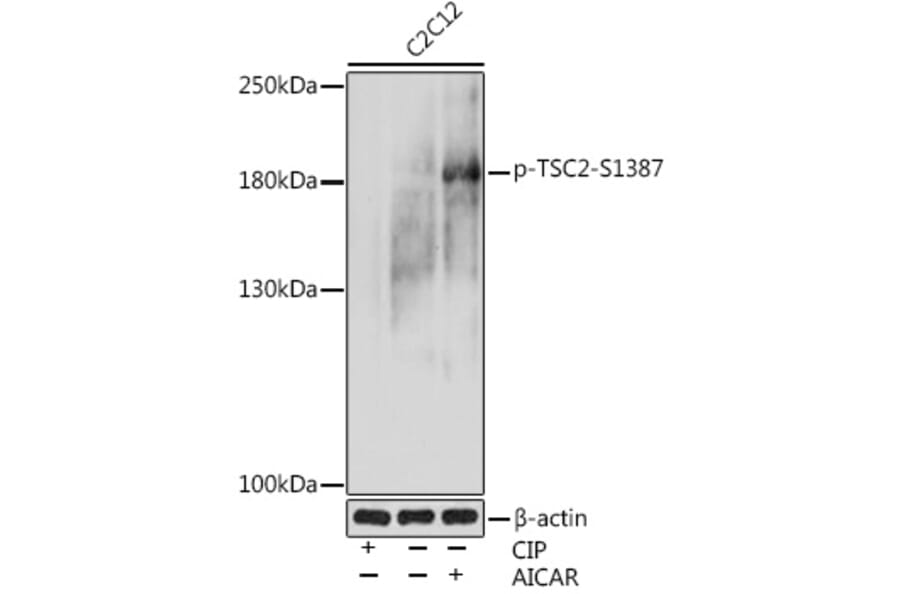 Western Blot - Anti-Tuberin (phospho Ser1387) Antibody (A308810) - Antibodies.com
