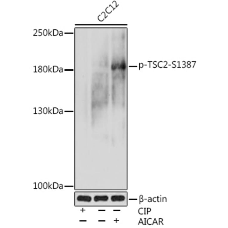 Western Blot - Anti-Tuberin (phospho Ser1387) Antibody (A308810) - Antibodies.com