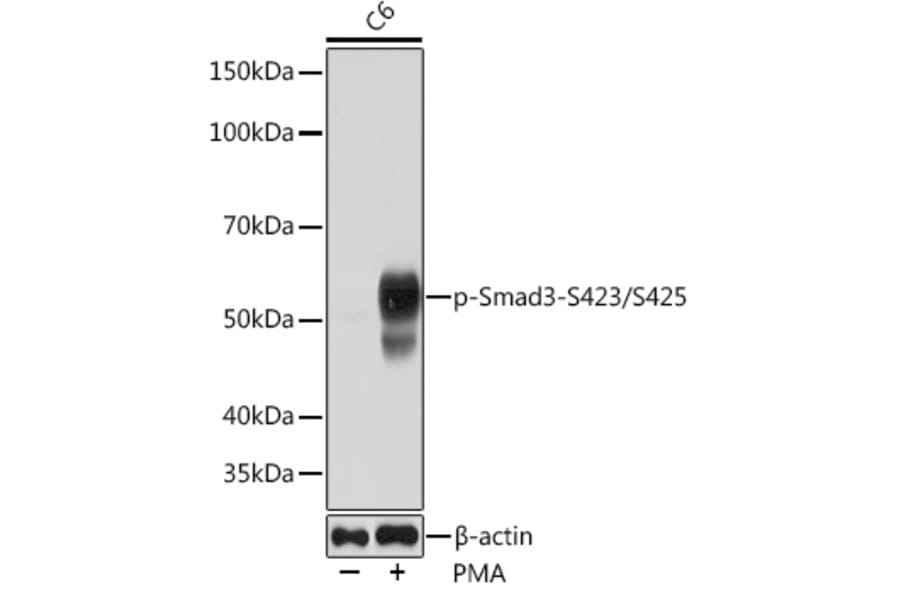 Western Blot - Anti-Smad3 (phospho Ser423 + Ser425) Antibody [ARC0170] (A308811) - Antibodies.com
