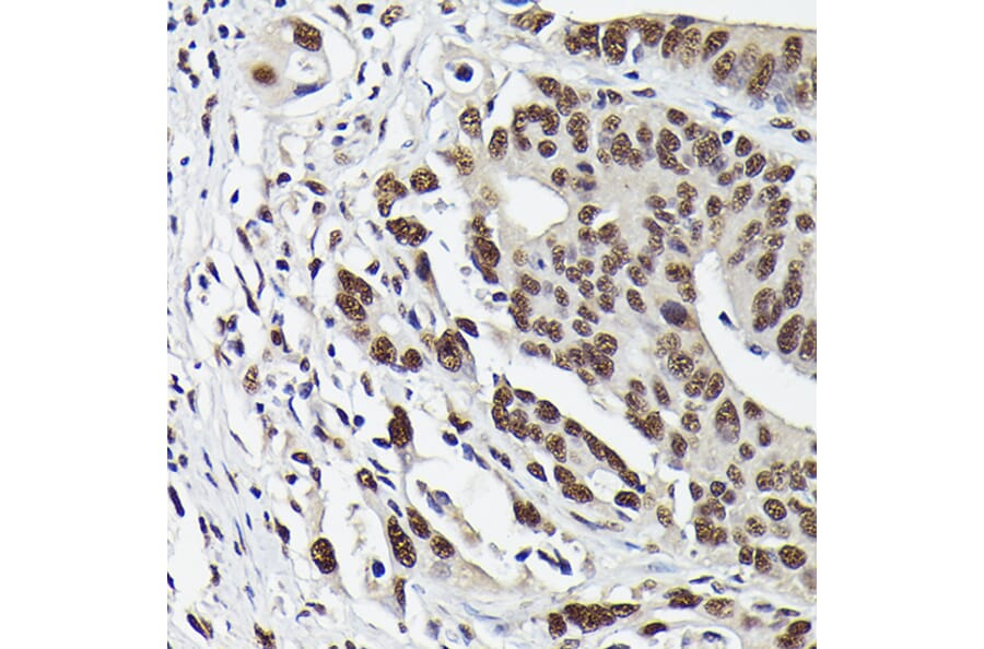 Immunohistochemistry - Anti-Smad3 (phospho Ser423 + Ser425) Antibody [ARC0170] (A308811) - Antibodies.com