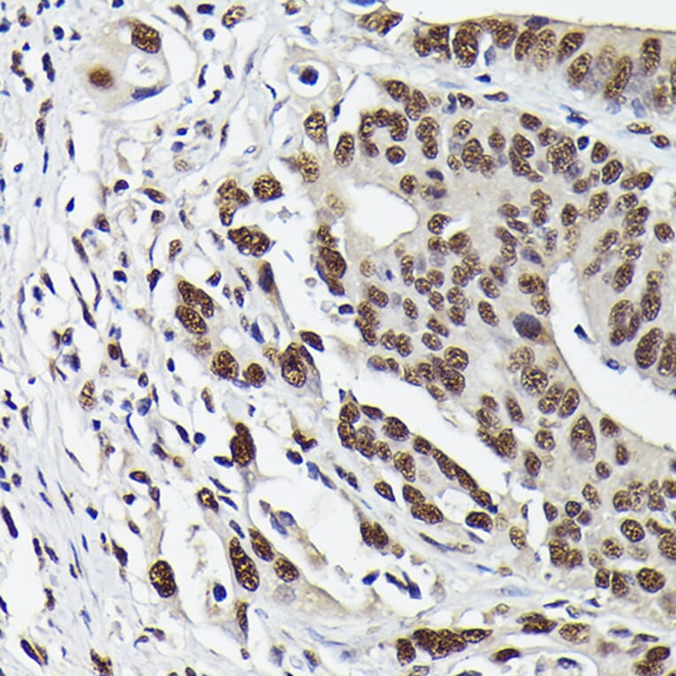 Immunohistochemistry - Anti-Smad3 (phospho Ser423 + Ser425) Antibody [ARC0170] (A308811) - Antibodies.com