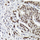 Immunohistochemistry - Anti-Smad3 (phospho Ser423 + Ser425) Antibody [ARC0170] (A308811) - Antibodies.com