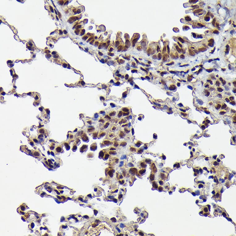 Immunohistochemistry - Anti-Smad3 (phospho Ser423 + Ser425) Antibody [ARC0170] (A308811) - Antibodies.com