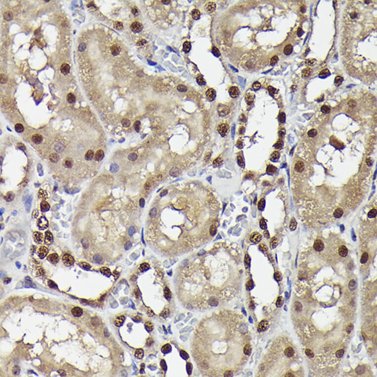Immunohistochemistry - Anti-Smad3 (phospho Ser423 + Ser425) Antibody [ARC0170] (A308811) - Antibodies.com