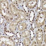 Immunohistochemistry - Anti-Smad3 (phospho Ser423 + Ser425) Antibody [ARC0170] (A308811) - Antibodies.com