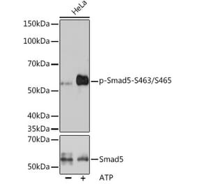Western Blot - Anti-SMAD5 (phospho Ser463 + Ser465) Antibody [ARC1568] (A308812) - Antibodies.com