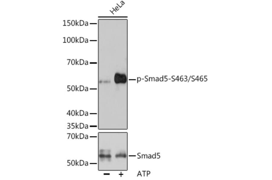 Western Blot - Anti-SMAD5 (phospho Ser463 + Ser465) Antibody [ARC1568] (A308812) - Antibodies.com