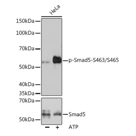 Western Blot - Anti-SMAD5 (phospho Ser463 + Ser465) Antibody [ARC1568] (A308812) - Antibodies.com