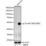 Western Blot - Anti-SMAD5 (phospho Ser463 + Ser465) Antibody (A308813) - Antibodies.com